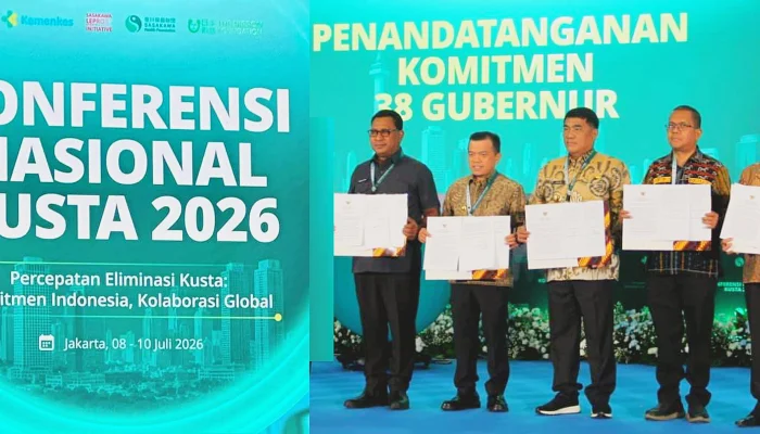 Target Sulut ‘Zero Leprosy’ 2030: Gubernur Yulius Pasang Badan Lindungi Penyintas Kusta dari Diskriminasi